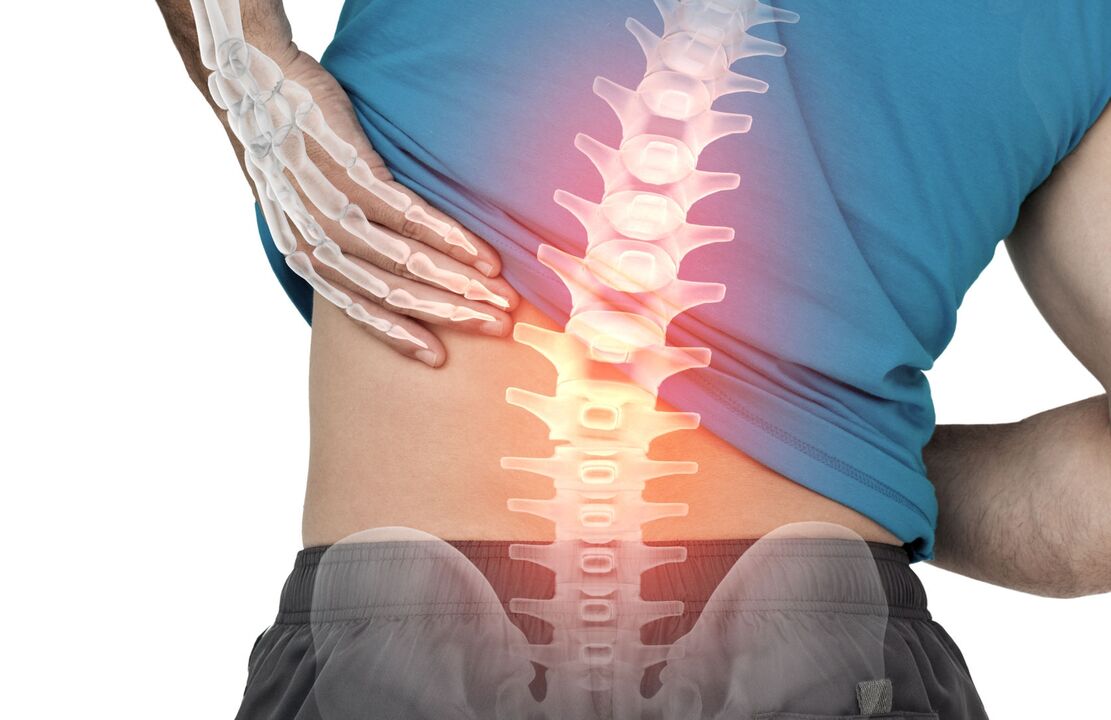 Danger of Ostehondroise Lumbar