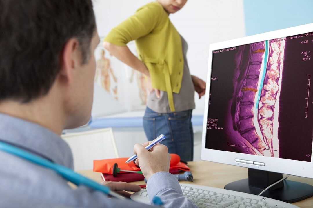 Diagnosis of Lumber of Osteochondrose