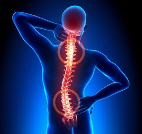 Osteochondrosis of spine