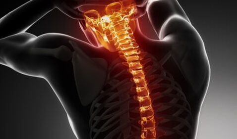 Osteochondrosis of the whole spine